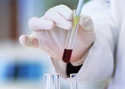 Health research at the University of Reading